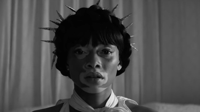 This Canadian Model Is Challenging Beauty 'Norms'