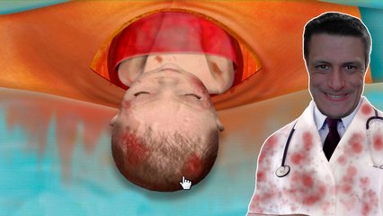 Como fazer uma cesariana