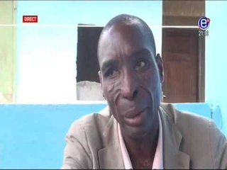 (Equinoxe TV) - Regard Social - Maladie rare déformatrice du visage - Extrait