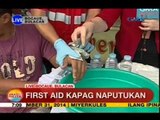 UB: First aid kapag naputukan