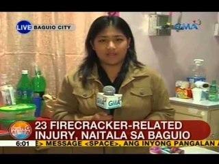 UB: 23 firecracker-related injury, naitala sa Baguio City