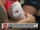 24Oras: Lalaki, puputulan ng kamay matapos sumabog ang pinulot na paputok