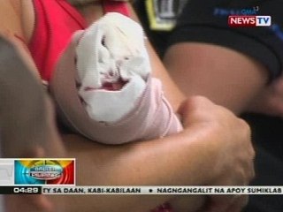 DOH: Bilang ng naitalang firecracker-related injuries simula Dec. 21, nasa 351