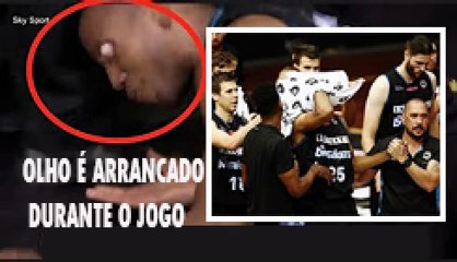 Impressionante atleta tem seu olho arrancado da órbita em jogo de basquete