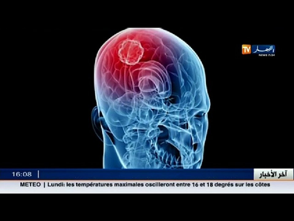 3 دقائق صحة    التكيسات في الرأس ..