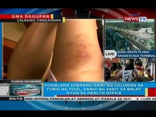 BP: 3 bata, namula, nangati at nabakbak ang balat matapos maligo sa swimming pool
