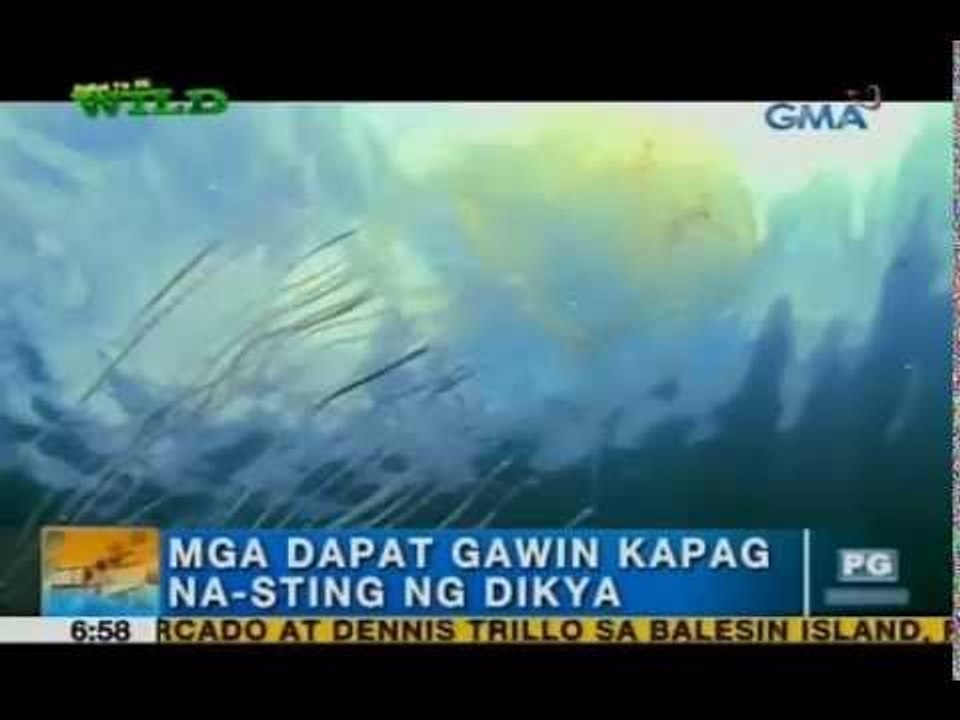 How to treat jellyfish sting | Unang Hirit