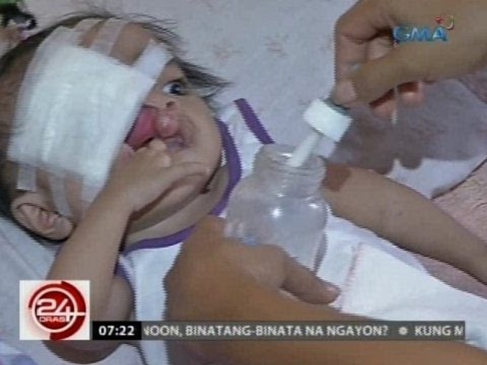 24 Oras: Bata, abot-noo ang bingot, kulang din ang mga daliri sa kamay
