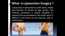 Liposuction Surgery in Vadodara, Gujarat