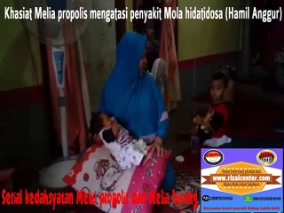 Kesaksian khasiat Melia propolis sebagai obat penyakit Mola atau Hamil Anggur