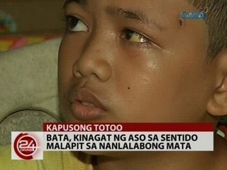 24Oras: Bata, kinagat ng aso sa sentido malapit sa nanlalabong mata