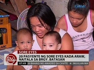 24Oras: 20 pasyente ng sore eyes kada araw, naitala sa Brgy. Batasan