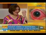 Simple ways to avoid having sore eyes | Unang Hirit