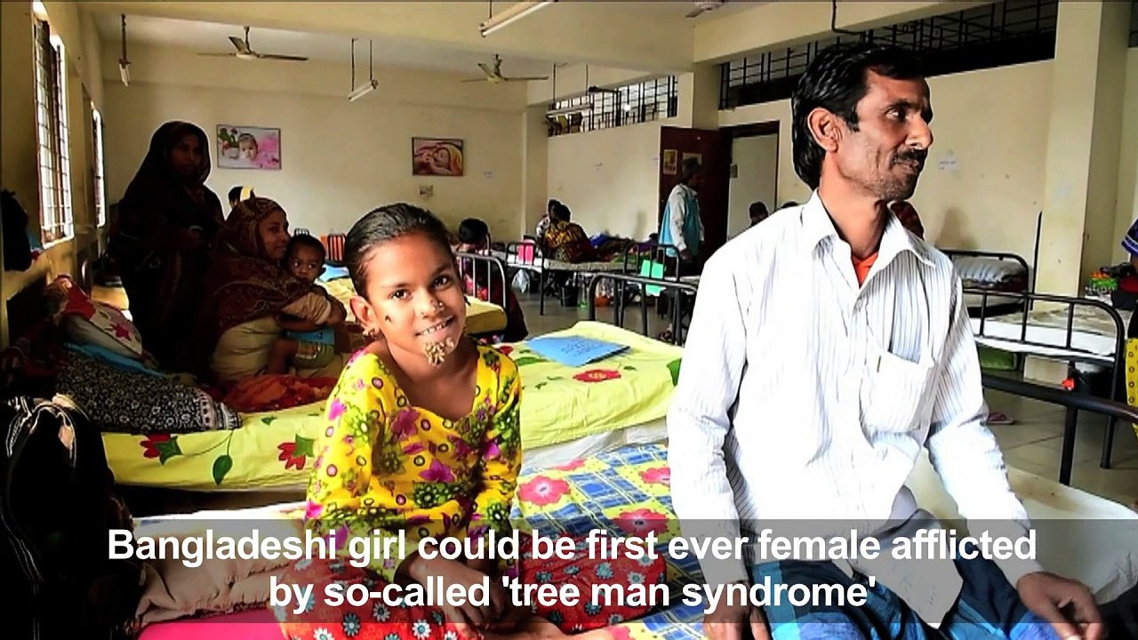 Bangladesh treats first case of 'tree girl' syndrome
