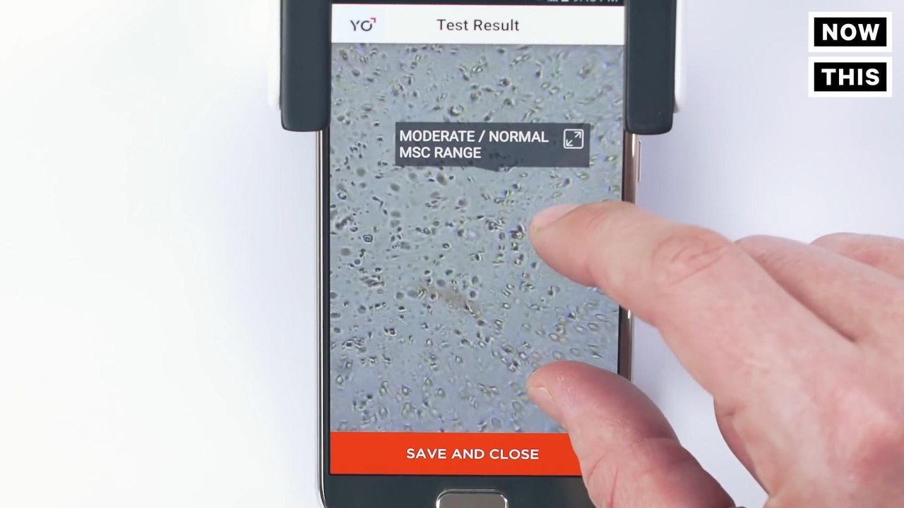 This Device Can Test Your Sperm Using Your Phone