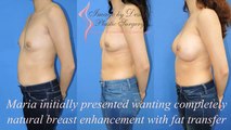 Natural Breast Augmentation in  St Clair Shores MI