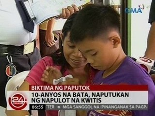 24Oras: 10-anyos na bata, naputukan ng napulot na kwitis
