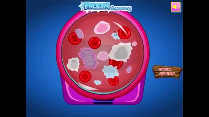 ❤ FROZEN Elsa Appendix Surgery Game - Doctor games for kids