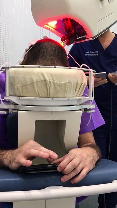 Greffe_capillaire_sans_douleur_The_Clinic_Paris