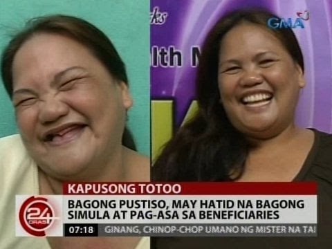 24 Oras: Bagong pustiso, may hatid na bagong simula at pag-asa sa beneficiaries