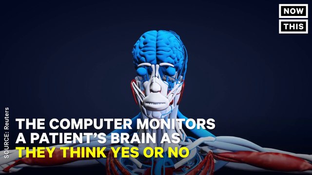 Scientists Have Made It Possible For People Who Are Completely Paralyzed To Communicate