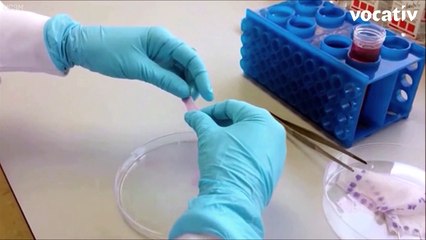 3D-Printer Creates Skin Made From Human Cells