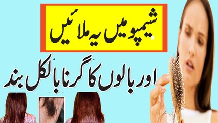Girtay Balon Ka Shartiya Girna Bilkul Band
