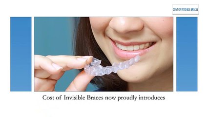 Affordable Invisible Braces - Watch Now!