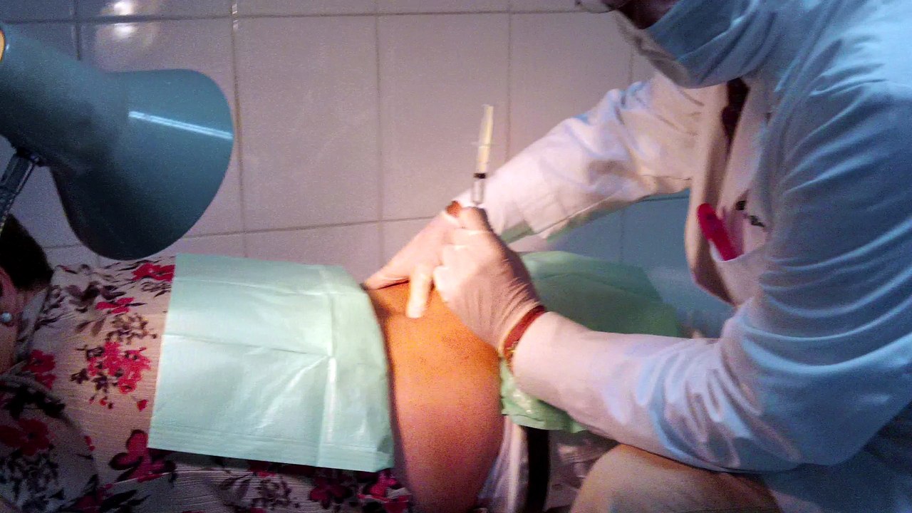 ozono discolisis paravertebral dr manuel diaz diaz