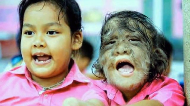 5 crianças que você não vai acreditar que existem