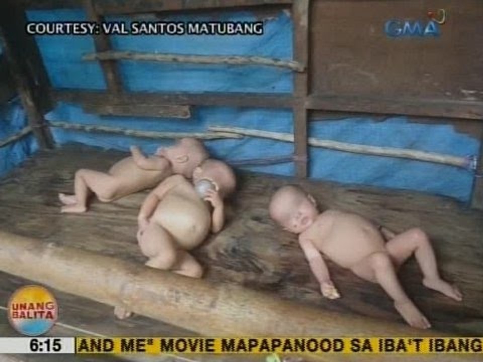 UB: Malnourished na triplets sa CamSur, nangangailangan ng tulong