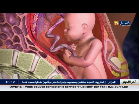 3 دقائق صحة العمليات القيصرية .... و تطوراتها