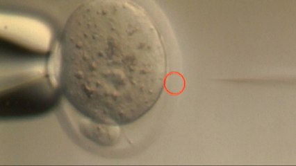 DNA breakthrough raises ethical questions