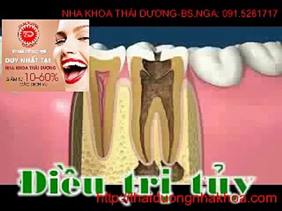 Nhakhoamedita.vn | Cùng tìm hiểu bọc răng sứ thẩm mỹ giá bao nhiêu