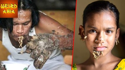 Girl GROWS Tree Bark On Body! | Weird Asia