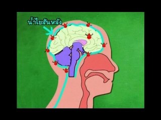 ตะลุยโรงหมอ _ เทป 40 .. ( ตอน "ไข้กาฬหลังแอ่น" )