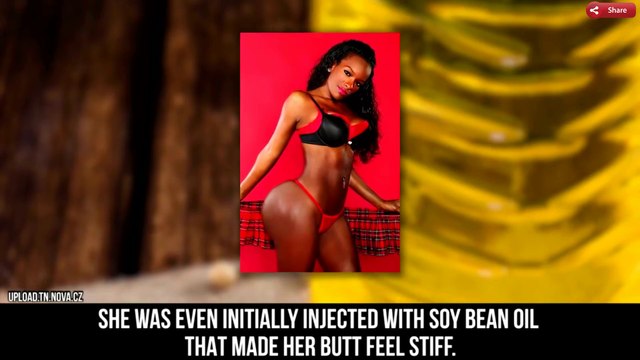 10 Most SHOCKING Body Part TRANSFORMATIONS ...