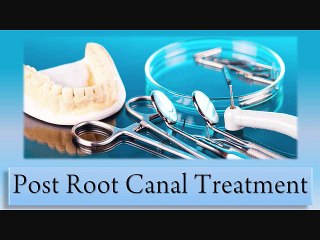 Post Root Canal Treatment