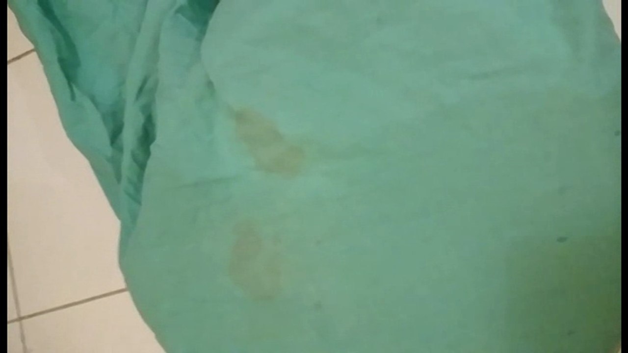 supprimer tache de sang sur un tissu déjà lavé