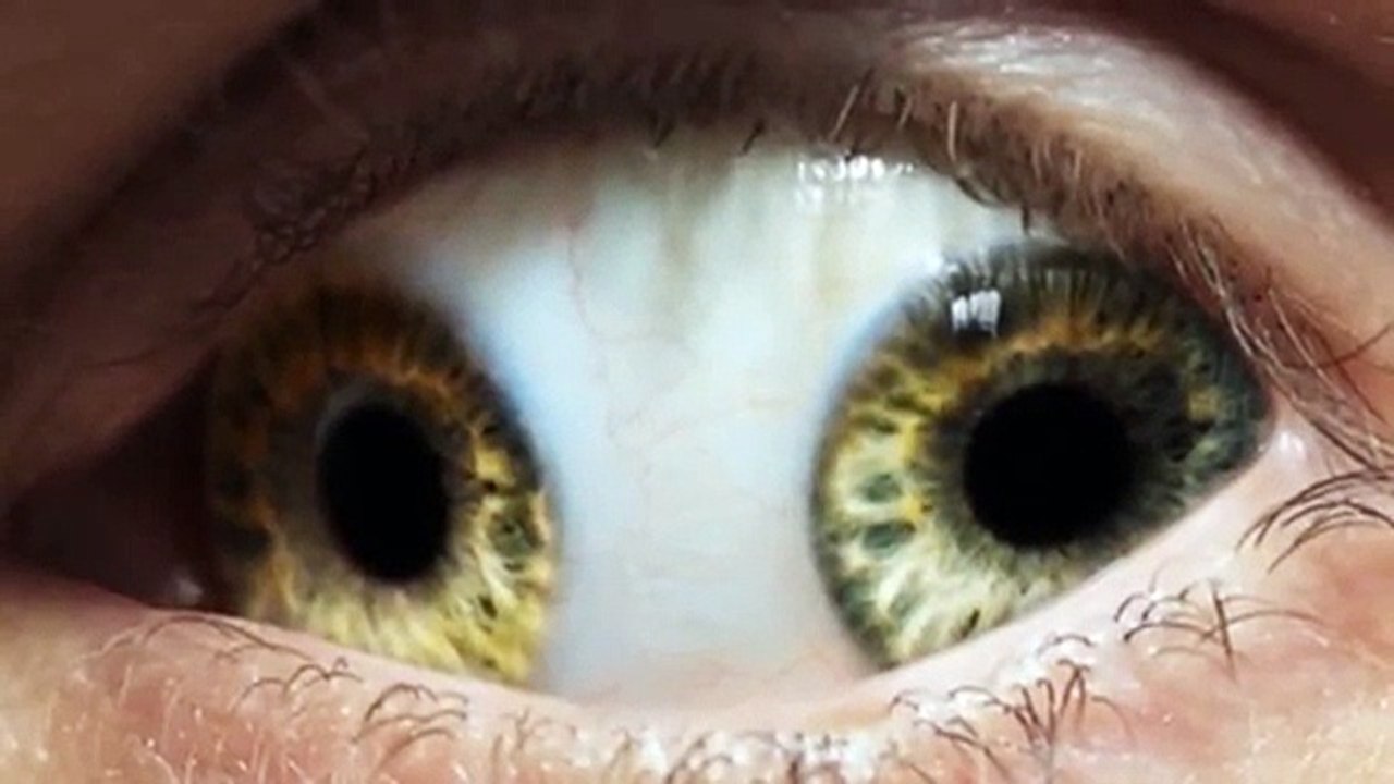 5 ESTRANHAS CONDIÇÕES MÉDICAS BIZARRAS