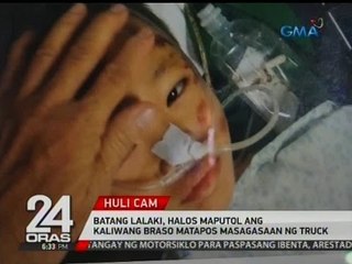 Exclusive: Batang lalaki, halos maputol ang kaliwang braso matapos masagasaan ng truck