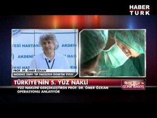 Prof.Dr. Ömer Özkan 5. yüz naklini  anlatıyor