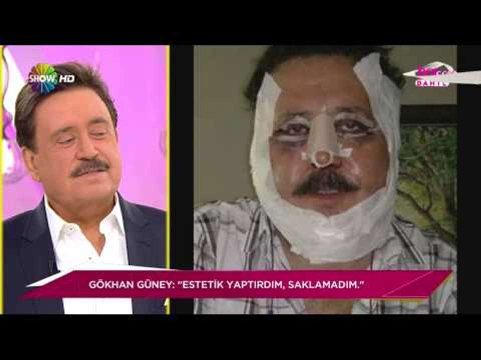 Gökhan Güney: "Estetik yaptırdım, saklamadım."