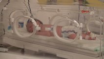 Mardin Nusaybin'de Yeni Doğan Bebek Yoğun Bakım Ünitesi