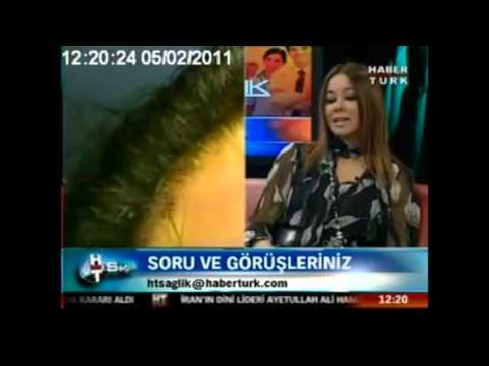 Neden kadınların saçları erkekler kadar dökülmez ?