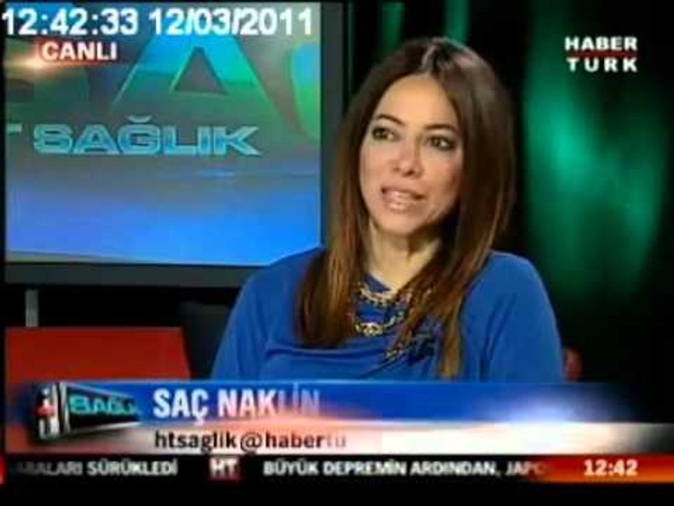 Saç naklinde ön testler var mıdır ?