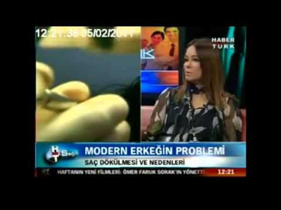 Türk erkeklerinin saç nakline daha yoğun ilgi göstermesinin sebebi nedir ?