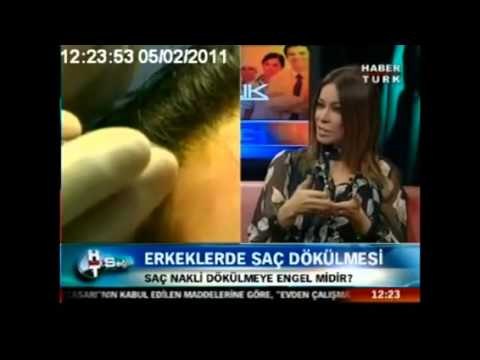 Saç nakli saç dökülmesini engeller mi ?