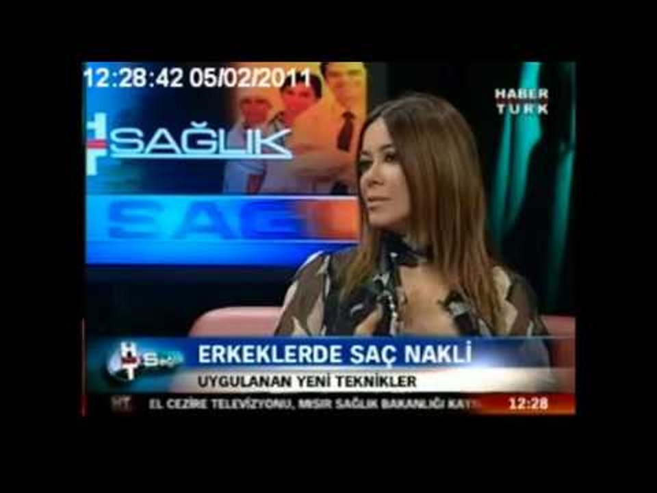 Saç naklinin aşamaları nelerdir ?