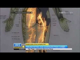Talk Show Tentang Penyebab Kesemutan -IMS